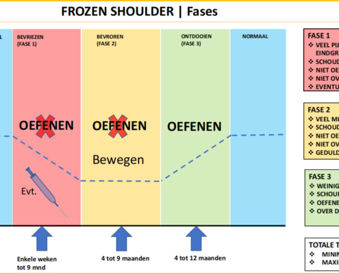 frozen-shoulder-fases-het-fysiohuis